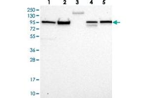 Western blot analysis of Lane 1: RT-4, Lane 2: U-251 MG, Lane 3: Human Plasma, Lane 4: Liver, Lane 5: Tonsil with FCHSD2 polyclonal antibody  at 1:250-1:500 dilution. (FCHSD2 anticorps)