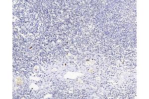 Immunohistochemistry analysis of paraffin-embedded Human amygdalitis using ITGAX Polyclonal Antibody at dilution of 1:200.