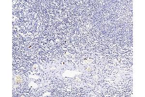 Immunohistochemistry analysis of paraffin-embedded Human amygdalitis using ITGAX Polyclonal Antibody at dilution of 1:200. (CD11c anticorps)