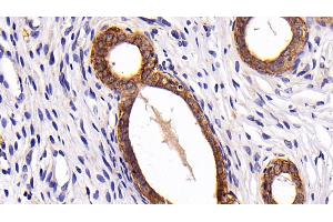 Detection of CK7 in Rat Uterus Tissue using Polyclonal Antibody to Cytokeratin 7 (CK7) (Cytokeratin 7 anticorps  (AA 91-394))