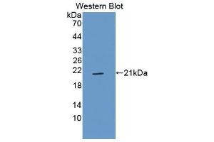 Figure. (CD42a anticorps  (AA 1-161))