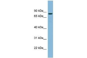 WB Suggested Anti-EPB41 Antibody Titration:  0. (EPB41 anticorps  (N-Term))