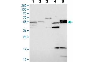 Western blot analysis of Lane 1: RT-4, Lane 2: U-251 MG, Lane 3: Human Plasma, Lane 4: Liver, Lane 5: Tonsil with SRFBP1 polyclonal antibody  at 1:250-1:500 dilution. (SRFBP1 anticorps)