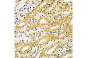 Immunohistochemistry of paraffin-embedded mouse kidney using ADCK3 antibody at dilution of 1:100 (x40 lens). (COQ8A anticorps)
