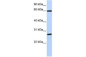 WB Suggested Anti-DNAJC1 Antibody Titration:  0. (DNAJC1 anticorps  (C-Term))