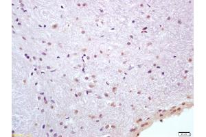 Formalin-fixed and paraffin embedded rat brain labeled with Anti-HSP70/HSPA1A Polyclonal Antibody, Unconjugated (ABIN1387822) at 1:200 followed by conjugation to the secondary antibody and DAB staining (HSP70 1A/ 1B (AA 500-600) anticorps)