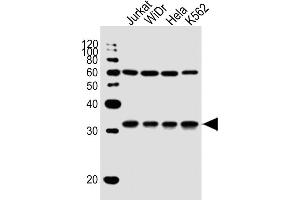 All lanes : Anti-EXOSC6 Antibody (N-term) at 1:1000 dilution Lane 1: Jurkat whole cell lysate Lane 2: WiDr whole cell lysate Lane 3: Hela whole cell lysate Lane 4: K562 whole cell lysate Lysates/proteins at 20 μg per lane. (EXOSC6 anticorps  (N-Term))