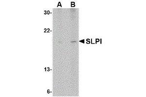 Western Blotting (WB) image for anti-Secretory Leukocyte Peptidase Inhibitor (SLPI) (Center) antibody (ABIN2476522)