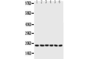 Anti-PLN antibody, Western blottingAll lanes: Anti PLN  at 0. (Phospholamban anticorps  (N-Term))