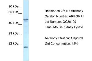 WB Suggested Anti-Zfp113 Antibody   Titration: 1. (Zfp113 anticorps  (Middle Region))