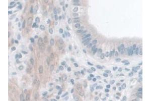 Detection of GLP1R in Mouse Uterus Tissue using Polyclonal Antibody to Glucagon Like Peptide 1 Receptor (GLP1R)