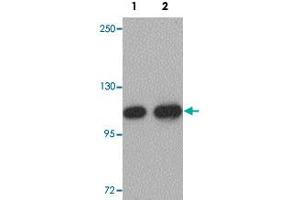 Western blot analysis of mouse liver tissue with CDC27 polyclonal antibody  at (Lane 1) 1 and (Lane 2) 2 ug/mL dilution. (CDC27 anticorps  (C-Term))