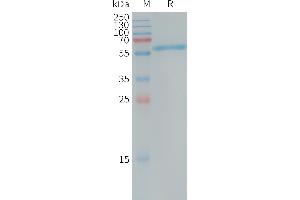 Human ALPP Protein, His Tag on SDS-PAGE under reducing condition.