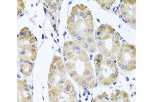 Immunohistochemistry of paraffin-embedded Human stomach using CBR4 Polyclonal Antibody at dilution of 1:100 (40x lens). (CBR4 anticorps)