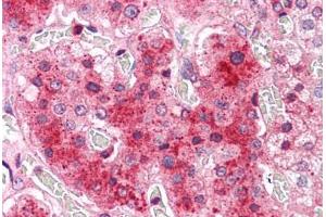 Human Adrenal: Formalin-Fixed, Paraffin-Embedded (FFPE) (COMT anticorps  (N-Term))