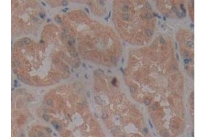 Detection of CD40 in Human Kidney Tissue using Polyclonal Antibody to Tumor Necrosis Factor Receptor Superfamily, Member 5 (CD40)