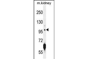 Western blot analysis in mouse kidney tissue lysates (35ug/lane). (CARNS1 anticorps  (N-Term))