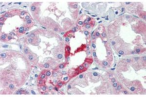 Immunohistochemistry with Human kidney lysate tissue at an antibody concentration of 5.