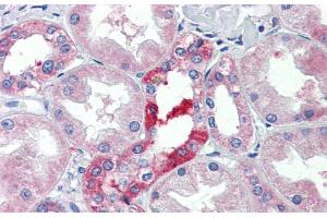 Immunohistochemistry with Human kidney lysate tissue at an antibody concentration of 5. (SLC25A28 anticorps  (C-Term))