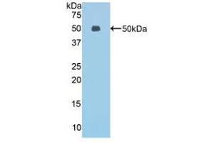 Western blot analysis of recombinant Mouse ESM1.