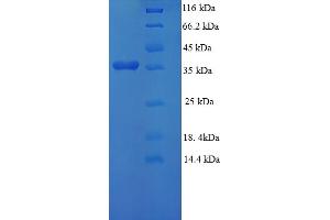 SDS-PAGE (SDS) image for gamma-Glutamylcyclotransferase (GGCT) (AA 1-188), (full length) protein (His-SUMO Tag) (ABIN5709573)