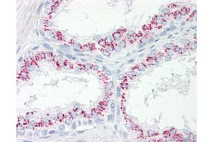 Anti-CPEB3 antibody IHC of human prostate. (CPEB3 anticorps  (AA 324-373))
