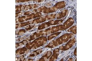 Immunohistochemical staining of human stomach with ALG13 polyclonal antibody  shows strong cytoplasmic positivity in glandular cells. (ALG13 anticorps)