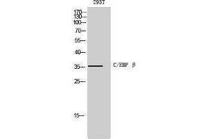 Western Blotting (WB) image for anti-CCAAT/enhancer Binding Protein (C/EBP), beta (CEBPB) (Ser243) antibody (ABIN3174087) (CEBPB anticorps  (Ser243))