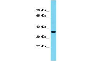 Host: Rabbit Target Name: C1orf222 Sample Type: Fetal Heart lysates Antibody Dilution: 1. (CFAP74/KIAA1751 anticorps  (C-Term))