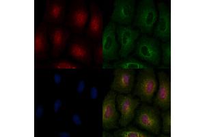 ABIN6263071 and ABIN6266879 staining  cells by IF/ICC. (Melanoma Antigen Family D, 4 (MAGED4) (C-Term) anticorps)