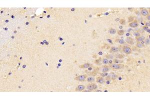 Detection of PEDF in Rat Cerebrum Tissue using Polyclonal Antibody to Pigment Epithelium Derived Factor (PEDF) (PEDF anticorps  (AA 20-418))