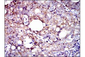 Image no. 3 for anti-Integrin beta 1 (ITGB1) antibody (ABIN1498894) (ITGB1 anticorps)