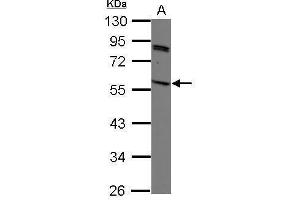 WB Image Sample (30 ug of whole cell lysate) A: K562 10% SDS PAGE antibody diluted at 1:1000 (SIRPG anticorps)