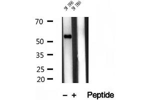 Western blot analysis of extracts of SW 1990 cells, using TMPRSS4 antibody. (TMPRSS4 anticorps  (Internal Region))