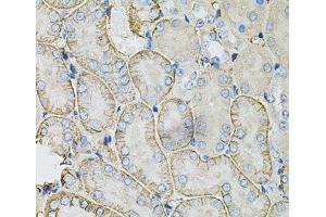 Immunohistochemistry of paraffin-embedded Mouse kidney using SLC4A4 / NBC Polyclonal Antibody at dilution of 1:100 (40x lens). (SLC4A4 anticorps)