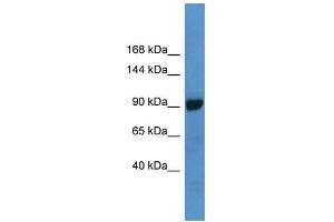 WB Suggested Anti-ABCC4 Antibody Titration: 1. (ABCC4 anticorps  (C-Term))