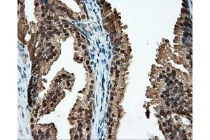 Immunohistochemical staining of paraffin-embedded liver tissue using anti-CUGBP1 mouse monoclonal antibody. (CELF1 anticorps)