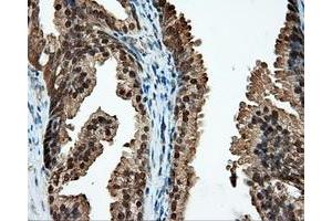 Immunohistochemical staining of paraffin-embedded liver tissue using anti-CUGBP1 mouse monoclonal antibody.