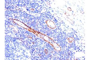 Formalin-fixed, paraffin-embedded human Tonsil stained with CD31 Mouse Monoclonal Antibody (C31.