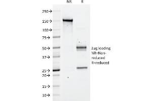 SDS-PAGE Analysis Purified CD43 Mouse Monoclonal Antibody (DF-T1).