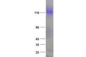 Validation with Western Blot