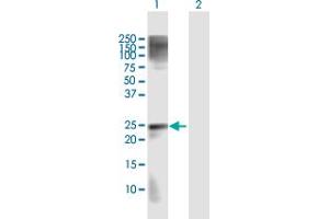 Western Blot analysis of MAD2L2 expression in transfected 293T cell line by MAD2L2 MaxPab polyclonal antibody.