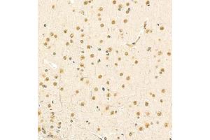 Immunohistochemistry of paraffin embedded rat brain using MED17 (ABIN7074579) at dilution of 1:1500 (200x lens) (MED17 anticorps)