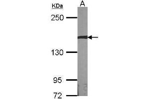 WB Image Sample (30 ug of whole cell lysate) A:NIH-3T3 5% SDS PAGE antibody diluted at 1:1000 (AUTS2 anticorps  (Internal Region))