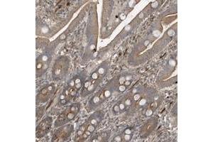 Immunohistochemical staining of human duodenum with PRRT3 polyclonal antibody  shows moderate cytoplasmic and membranous positivity in glandular cells. (PRRT3 anticorps)