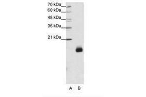 Image no. 1 for anti-Ribosomal Protein S14 (RPS14) (N-Term) antibody (ABIN203013) (RPS14 anticorps  (N-Term))