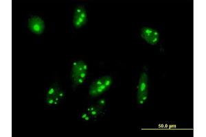 Immunofluorescence of purified MaxPab antibody to C1orf87 on HeLa cell. (C1orf87 anticorps  (AA 1-546))