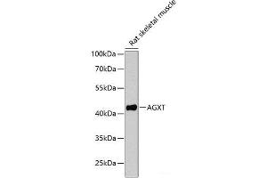 Western blot analysis of extracts of Rat skeletal muscle using AGXT Polyclonal Antibody at dilution of 1:1000. (AGXT anticorps)