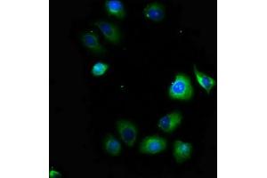 Immunofluorescence staining of A549 cells with ABIN7169933 at 1:100, counter-stained with DAPI. (SCN1B anticorps  (AA 44-156))