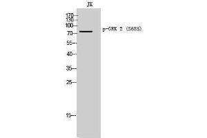 Western Blotting (WB) image for anti-Adrenergic, Beta, Receptor Kinase 1 (ADRBK1) (pSer685) antibody (ABIN3173109) (GRK2 anticorps  (pSer685))
